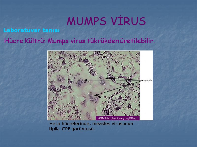 Hücre Kültrü: Mumps virus tükrükden üretilebilir. MUMPS VİRUS Laboratuvar tanısı HeLa hücrelerinde, measles virusunun